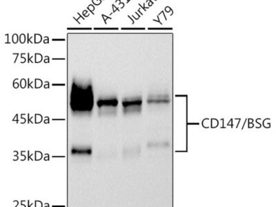 CD147/BSG Rabbit mAb (A22443)