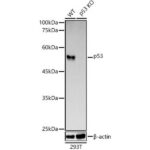 [KO Validated] p53 Rabbit mAb (A22449)