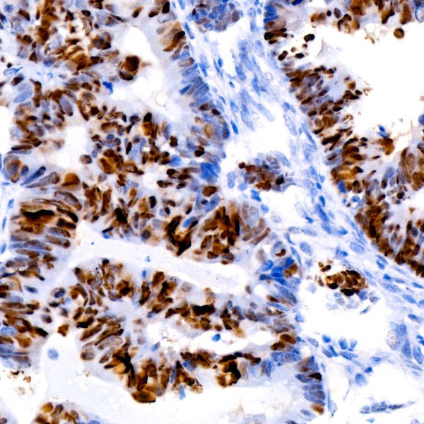 A22449: [KO Validated] p53 Rabbit mAb