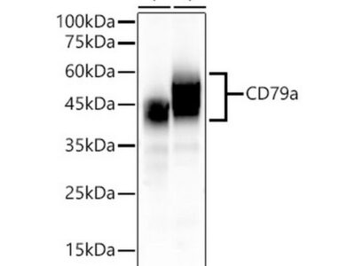 CD79a Rabbit mAb (A22452)