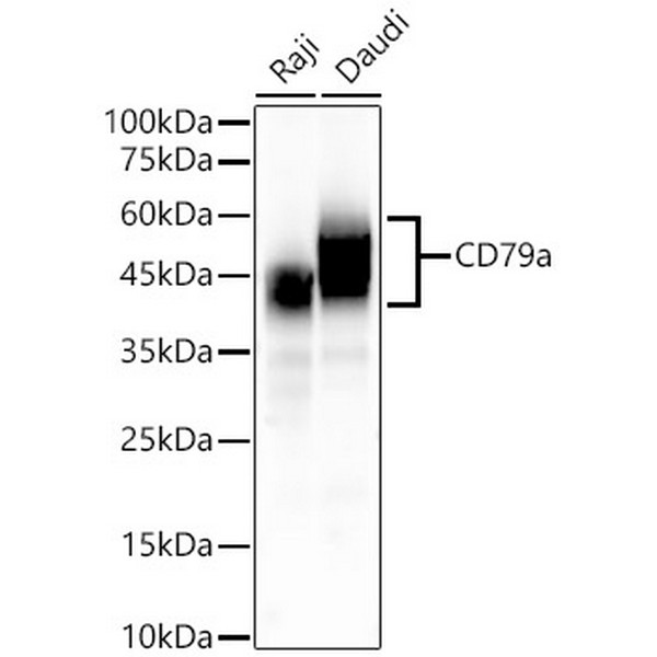 CD79a Rabbit mAb (A22452)
