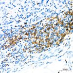 CD79a Rabbit mAb (Catalog Number: A22452)