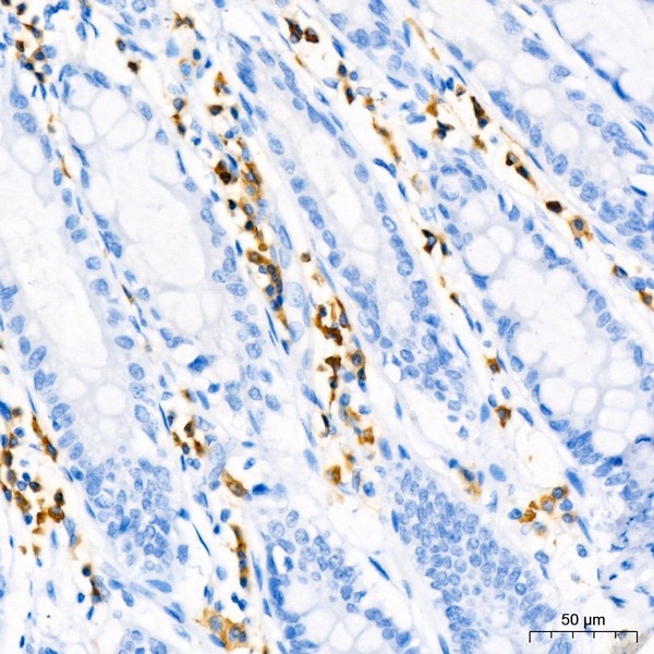 Abclonal CD79a Rabbit mAb (Catalog Number: A22452)
