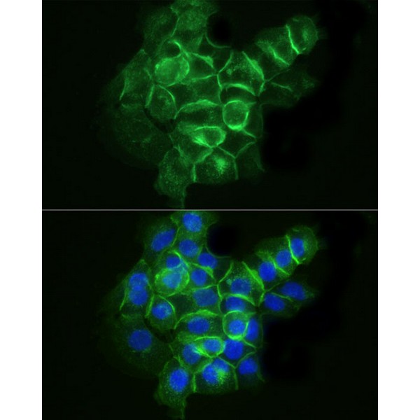 ABflo® 488 Rabbit anti-Human CD142 mAb (A22492) ABflo® 488 Rabbit anti-Human CD142 mAb (A22492)