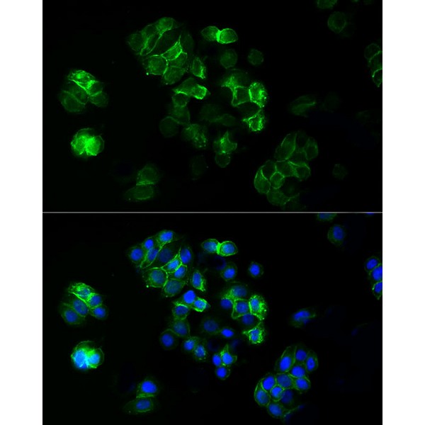 ABflo® 488 Rabbit anti-Human TROP-2 mAb (A22577) ABflo® 488 Rabbit anti-Human TROP-2 mAb (A22577)