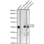 TdT Rabbit mAb (A22618)