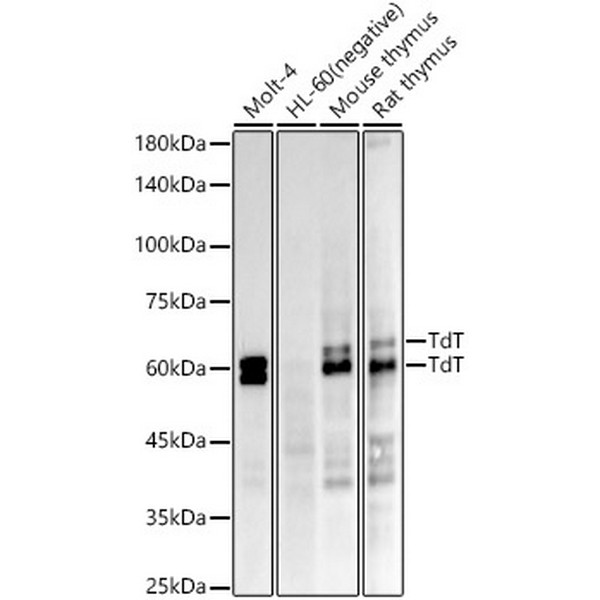 TdT Rabbit mAb (A22618)