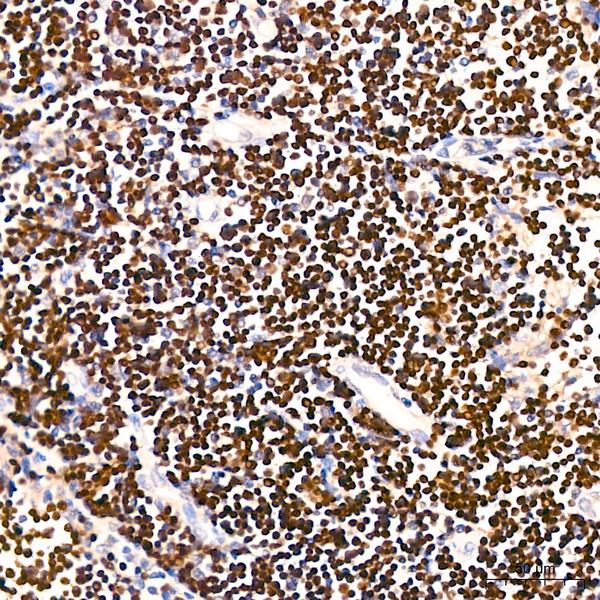 A22618: TdT Rabbit mAb