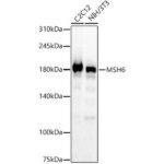 [KO Validated] MSH6 Rabbit mAb (A22652)