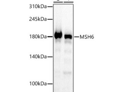 [KO Validated] MSH6 Rabbit mAb (A22652)