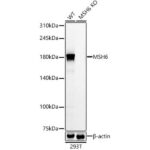 [KO Validated] MSH6 Rabbit mAb (Catalog Number: A22652) Abclonal