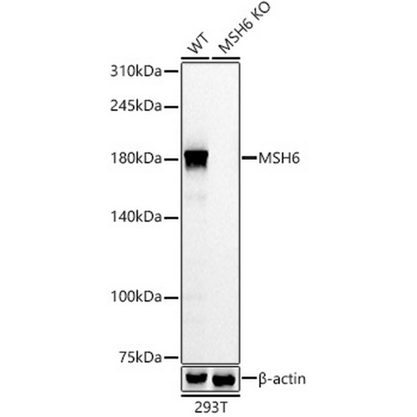 [KO Validated] MSH6 Rabbit mAb (Catalog Number: A22652) Abclonal