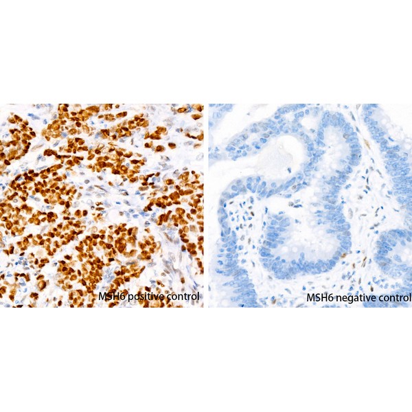 Abclonal [KO Validated] MSH6 Rabbit mAb (Catalog Number: A22652)