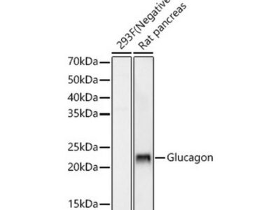 Glucagon Rabbit mAb (A22702)
