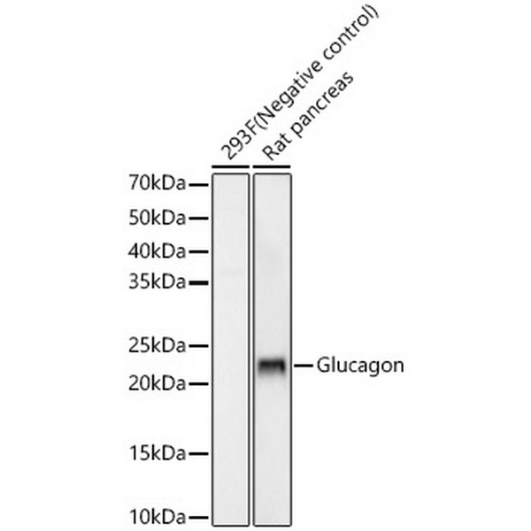 Glucagon Rabbit mAb (A22702) Glucagon Rabbit mAb (A22702)