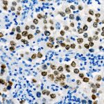 Sall4 Rabbit mAb (A22747)