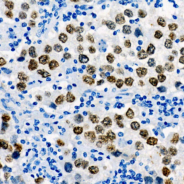 Sall4 Rabbit mAb (A22747) Sall4 Rabbit mAb (A22747)