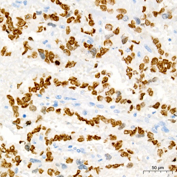 A22747: Sall4 Rabbit mAb
