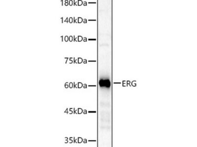 ERG Rabbit mAb (A22748)