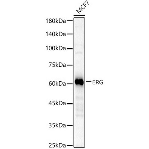 ERG Rabbit mAb (A22748) ERG Rabbit mAb (A22748)