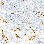 ERG Rabbit mAb (Catalog Number: A22748) Abclonal