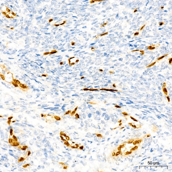 ERG Rabbit mAb (Catalog Number: A22748) Abclonal
