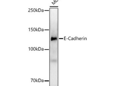 E-Cadherin Rabbit mAb (A22850)