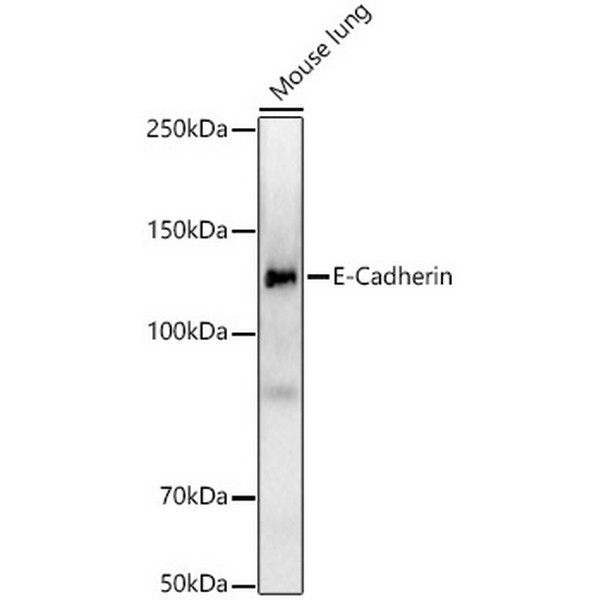 E-Cadherin Rabbit mAb (A22850) E-Cadherin Rabbit mAb (A22850)