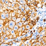A22850: E-Cadherin Rabbit mAb