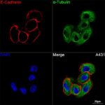 Abclonal E-Cadherin Rabbit mAb (Catalog Number: A22850)