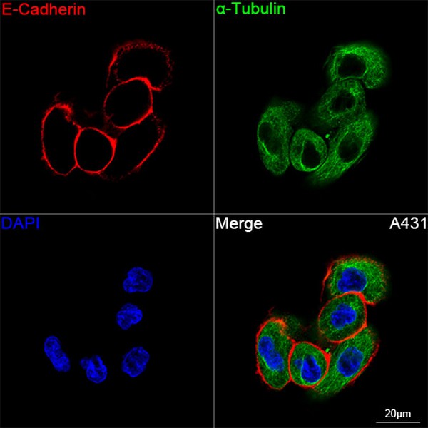 Abclonal E-Cadherin Rabbit mAb (Catalog Number: A22850)