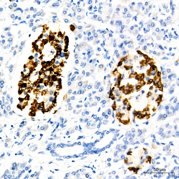 Glucagon Rabbit mAb (A23029) Glucagon Rabbit mAb (A23029)
