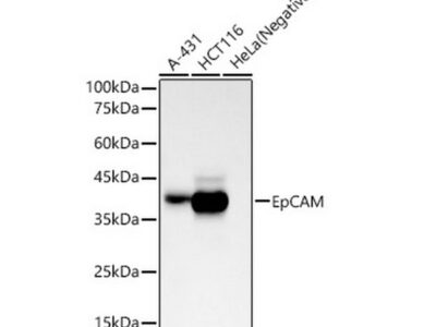 EpCAM Rabbit mAb (A23075)