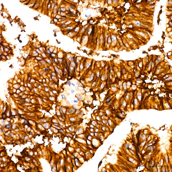 A23075: EpCAM Rabbit mAb