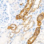 EpCAM Rabbit mAb (Catalog Number: A23075) Abclonal