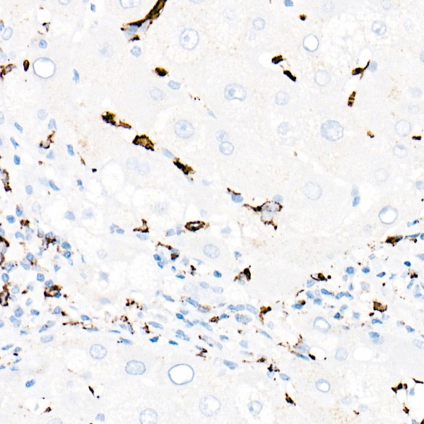CD68 Rabbit mAb (Catalog Number: A23205) Abclonal