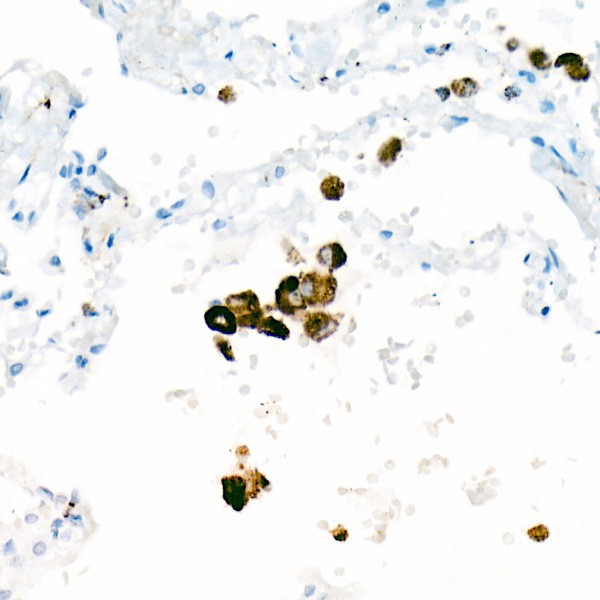 Abclonal CD68 Rabbit mAb (Catalog Number: A23205)