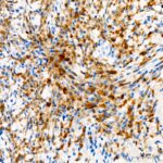 Tyrosinase Rabbit mAb (A23209)