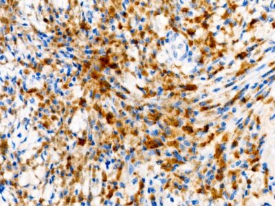 Tyrosinase Rabbit mAb (A23209)