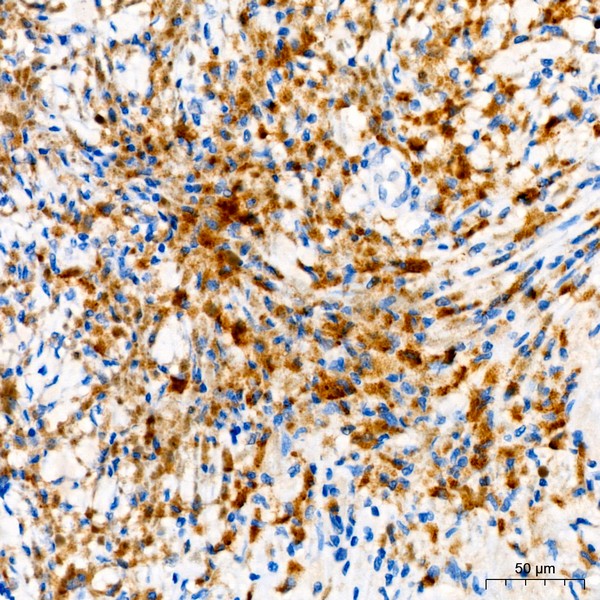 Tyrosinase Rabbit mAb (A23209) Tyrosinase Rabbit mAb (A23209)