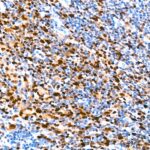 IRF4 Rabbit mAb (A23227)