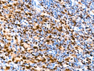 IRF4 Rabbit mAb (A23227)