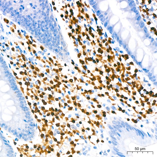 A23227: IRF4 Rabbit mAb