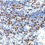 IRF4 Rabbit mAb (Catalog Number: A23227) Abclonal