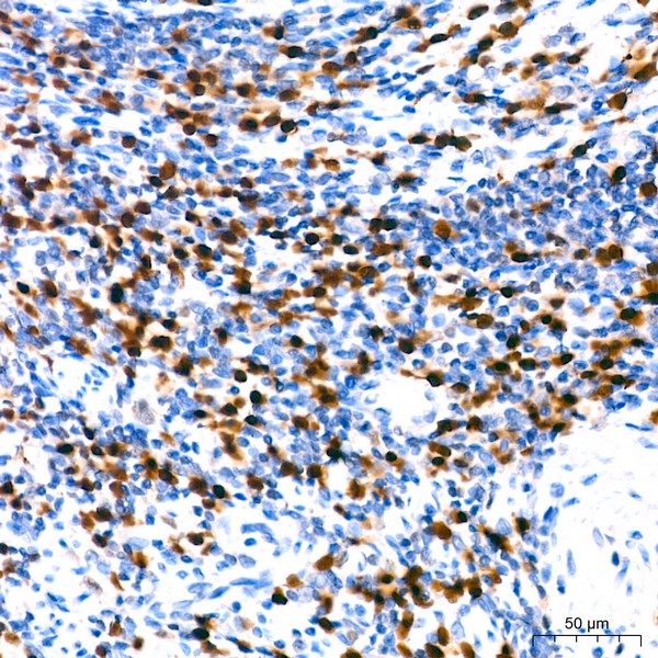 IRF4 Rabbit mAb (Catalog Number: A23227) Abclonal