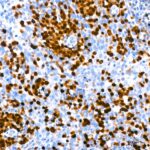 Abclonal IRF4 Rabbit mAb (Catalog Number: A23227)