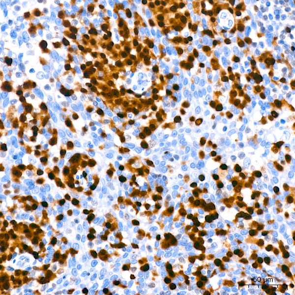 Abclonal IRF4 Rabbit mAb (Catalog Number: A23227)