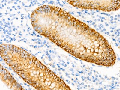 CD138/Syndecan-1 Rabbit mAb (A23248)