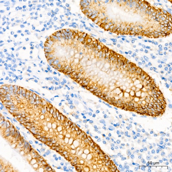 CD138/Syndecan-1 Rabbit mAb (A23248) CD138/Syndecan-1 Rabbit mAb (A23248)