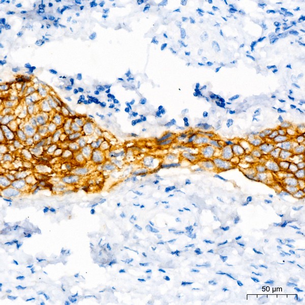 A23248: CD138/Syndecan-1 Rabbit mAb